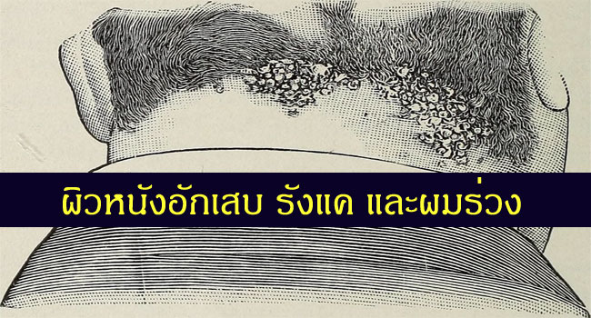 รักษาผมร่วงโดยไม่ต้องใช้ยากินปลูกผม ใช้การปฏิบัติตัว เสริมอาหารโภชนาการและวิตามิน